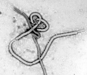 Ebola, il medico di Quart «sarà classificato come contatto a rischio intermedio»