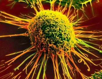 Sanità, ok all'accreditamento nazionale del Registro Tumori della Valle d'Aosta