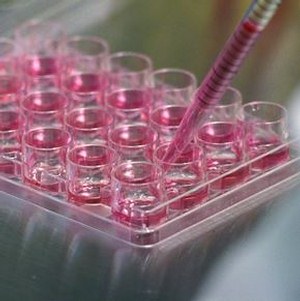 ADMO, sette valdostani hanno donato le cellule staminali