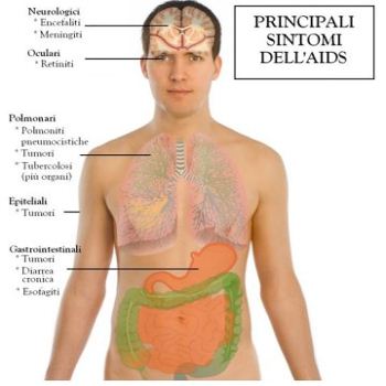 La salute su Aostaoggi.it: Aids, una malattia dimenticata ma non ancora scomparsa