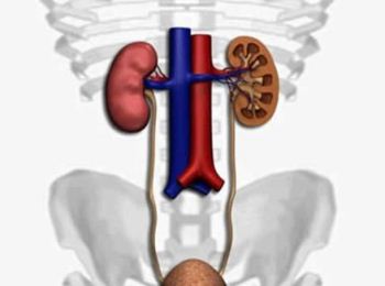 La colica renale: cause, sintomi, cura e prevenzione