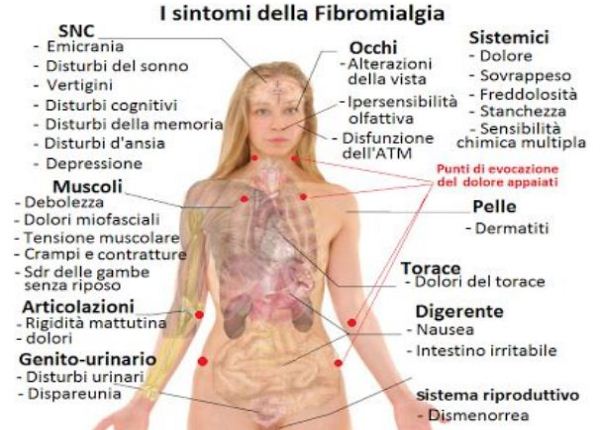 fibromialgia