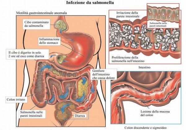 Gastroenteriti infettive: le cause, i sintomi, la cura e la prevenzione
