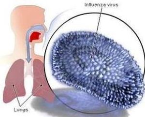 influenza