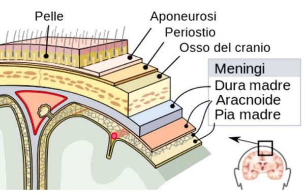 meningite batterica