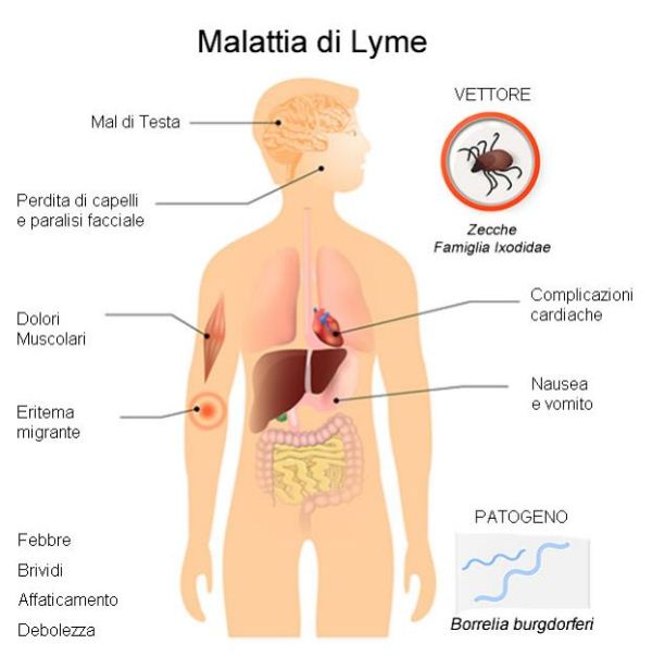 Malattia di Lyme Malattia di Lyme