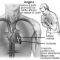 L'angina pectoris: come riconoscerla, curarla e prevenirla